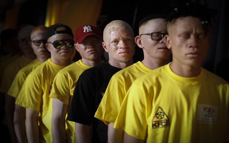 epa07200599 Albino men stand in line as they rehearse for their show prior to the Mr. & Miss Albinism East Africa contest in Nairobi, Kenya, 30 November 2018. Hudreds of albino men, women and children participated in the contest to raise awareness on discrimination and stigma against albinism in the region. EPA/DAI KUROKAWA